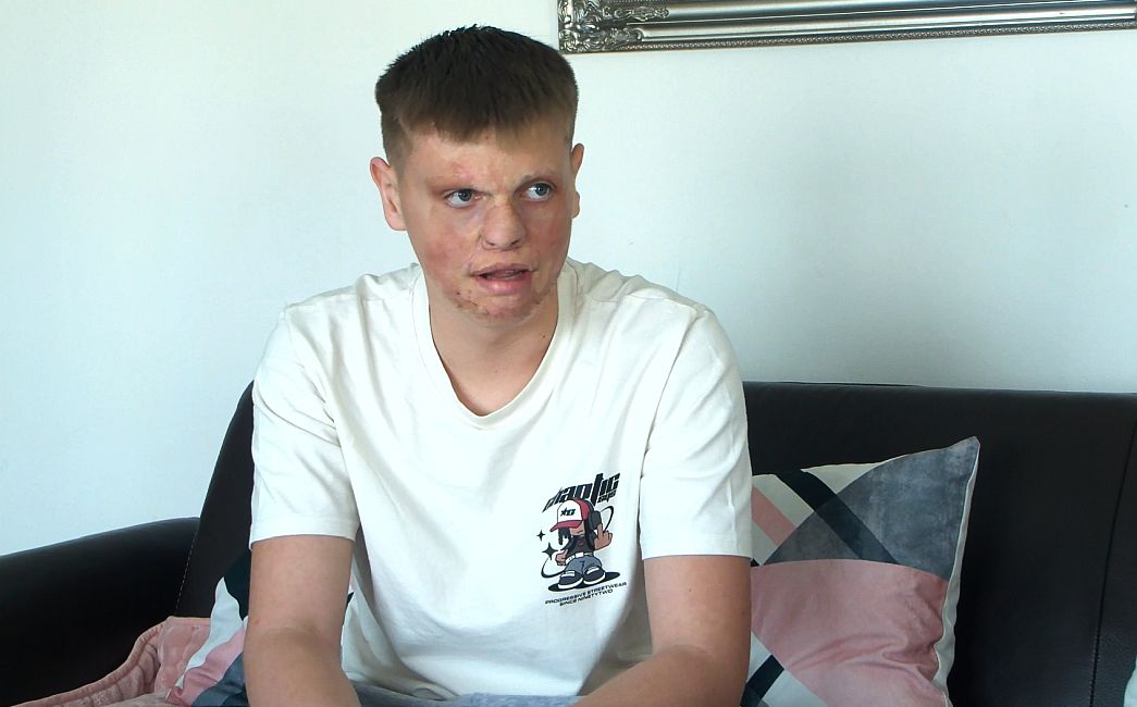 PRIČA O KRISTIJANU - Pomozimo dječaku koji više ne želi skrivati svoje lice