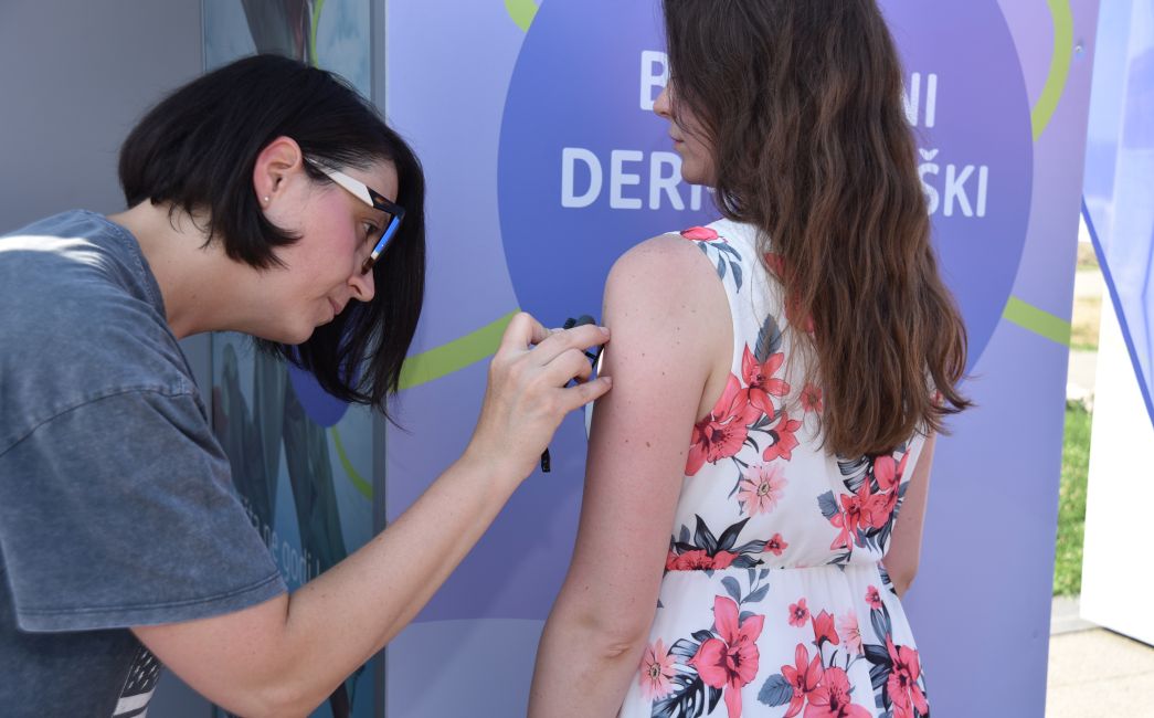  U subotu na 'Poloju' besplatno pregledajte kožu i savjetujte se sa stručnjacima