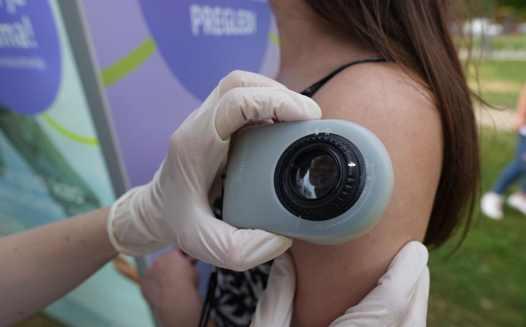 U Slavonskom Brodu 181 građanin besplatno pregledao kožu, na daljnje preglede upućeno osmero ljudi